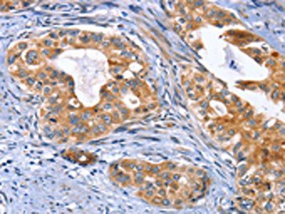 MUSK Antibody