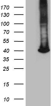 Mutarotase (GALM) antibody
