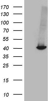 Mutarotase (GALM) antibody
