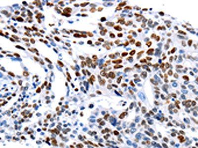 MUTYH Antibody