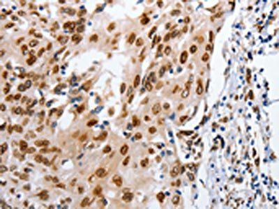 MUTYH Antibody