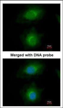 mevalonate diphosphate decarboxylase Antibody