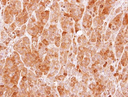 MVD Rabbit Polyclonal Antibody