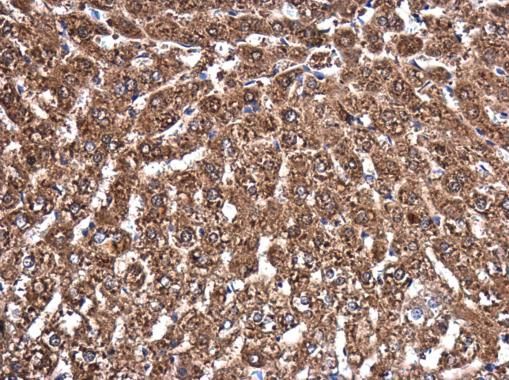 MVD antibody [N1C1]