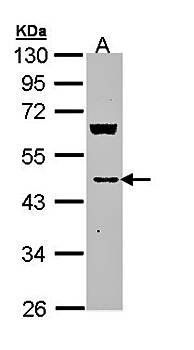 MVD antibody