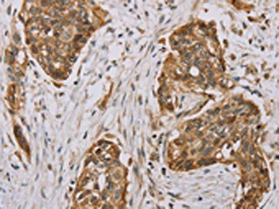 MVK Antibody