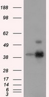 MX1 antibody