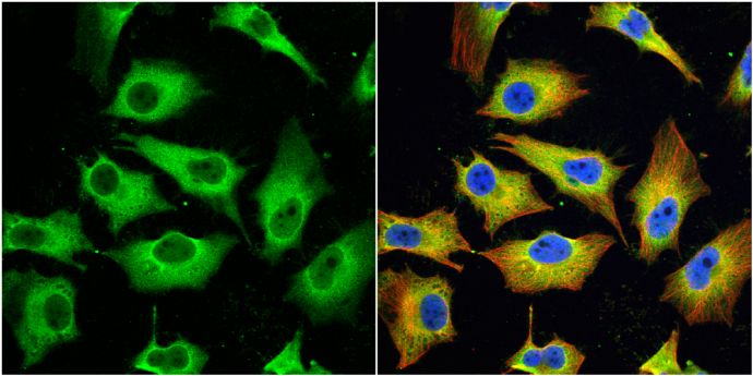 MX1 antibody