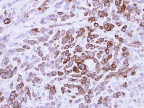 MX1 antibody