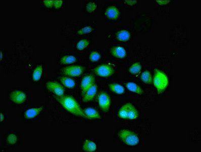MYADM Antibody