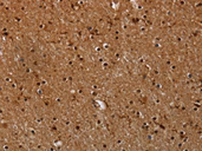 MYBBP1A Antibody