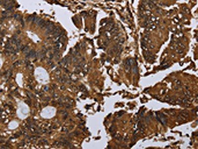 MYBBP1A Antibody