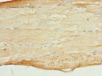 MYBPC2 Antibody