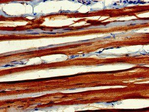 MYBPC2 Antibody