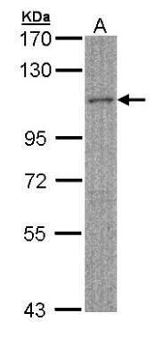 MYBPC2 Rabbit Polyclonal Antibody