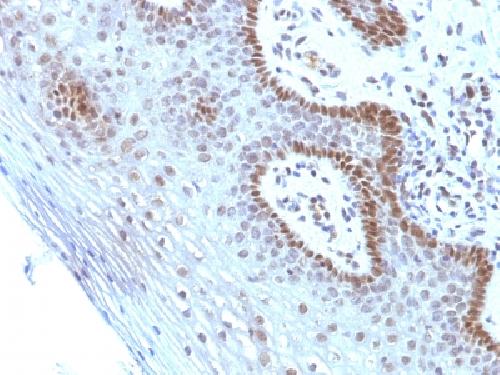 c-Myc Oncoprotein Antibody