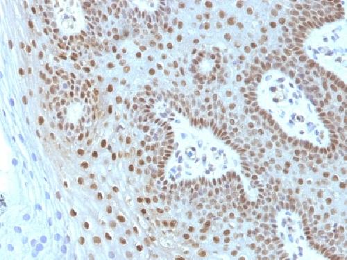 c-Myc Oncoprotein Antibody