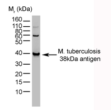 MYCOBACTERIUM TUBERCULOSIS antibody