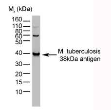 MOUSE ANTI MYCOBACTERIUM TUBERCULOSIS 38kDa ANTIGEN