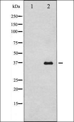 MyD88 antibody