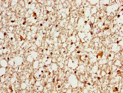 Myelin-associated glycoprotein antibody