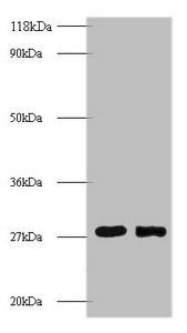 Myelin protein P0 antibody