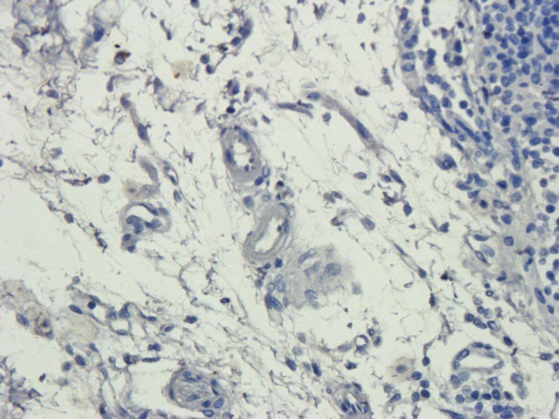 Myeloperoxidase Rabbit Polyclonal Antibody
