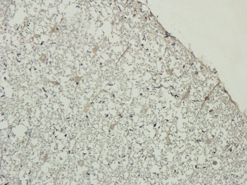 Myeloperoxidase Rabbit Polyclonal Antibody