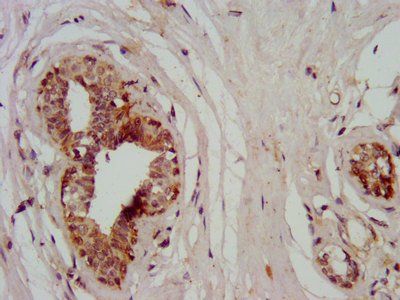 MYH11 antibody