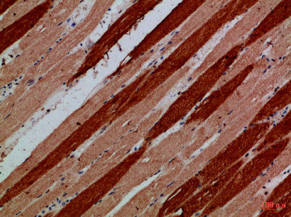 MYH6/MYH7 Antibody