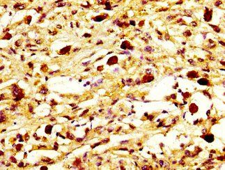 MYH7 Antibody