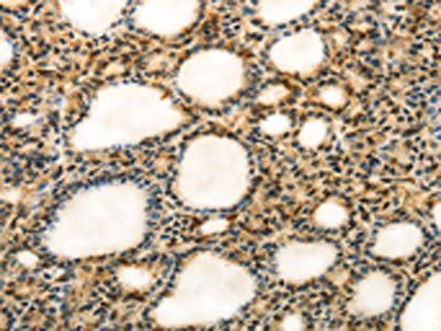 MYH7 Antibody