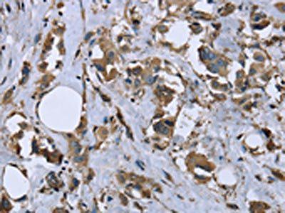 MYL12B antibody