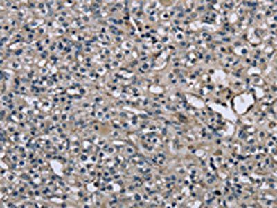 MYL12B Antibody