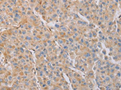 MYL6 antibody