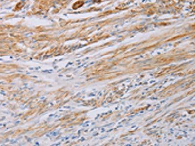 MYL6 Antibody