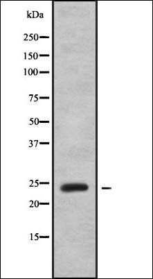 MYL6B antibody
