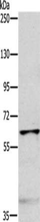 MYLK2 Antibody