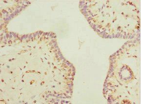 MYLK3 Antibody