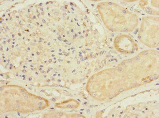 MYLK4 Antibody