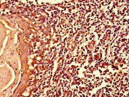 MYO10 Antibody