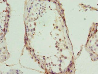 MYO1C antibody