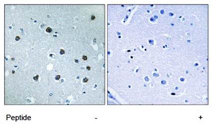 MYO1D antibody