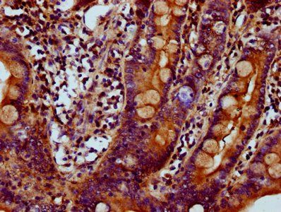 MYO1E Antibody