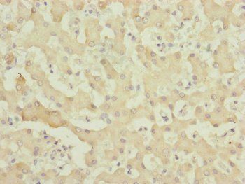 MYO5B antibody