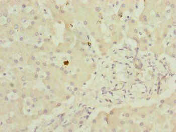 MYO5B Antibody