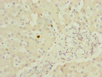 MYO5B antibody