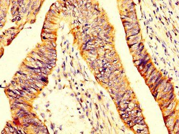 MYOC antibody