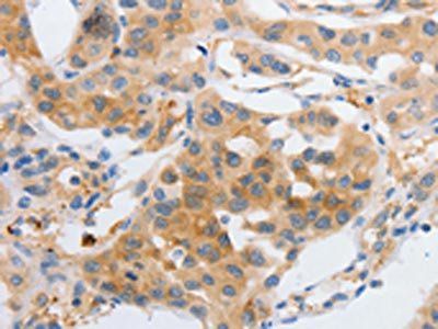 MYOD1 Antibody