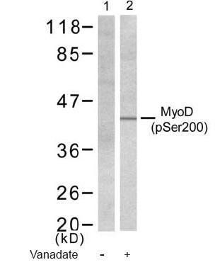 MyoD (Phospho-Ser200) Antibody